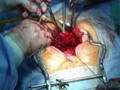 specjalista urolog - operacja