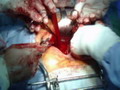 specjalista urolog - operacja